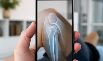 Simule Raio-X no iOS com Realidade Aumentada