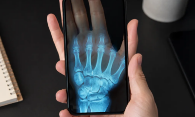 Veja Como Funciona o Efeito de Raio-X no Seu Celular