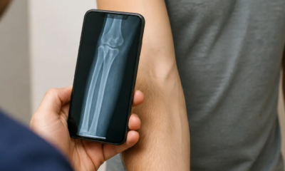 Aplicativo de Raio-X pela Câmera para Android: Veja Como Funciona