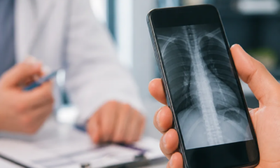 Novo App de Raio-X Para Celular Android Revoluciona Diagnósticos Rápidos