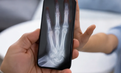 Aplicativo de Raio-X pela Câmera do Android Funciona Mesmo