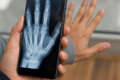 Aplicativo de Raio-X pela Câmera que Funciona no Android Agora