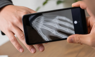 Aplicativo para simular raio-X pela câmera do Android funciona mesmo?