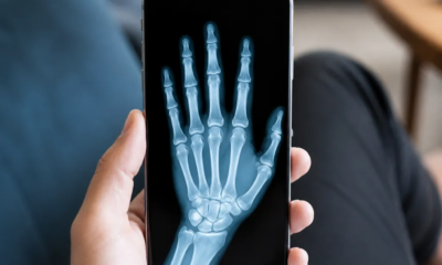 Applicazione gratuita Crea immagini con effetto X Ray su Android