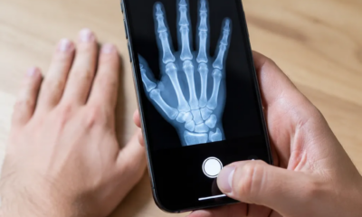 Hvordan lage simulert X Ray på iPhone med kamera