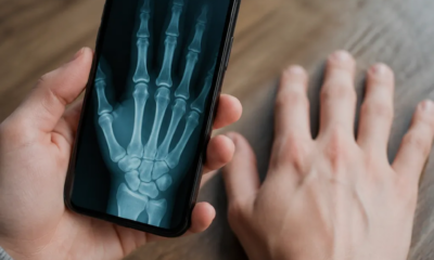 Veja como funciona raio-x simulado no seu iPhone