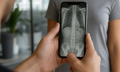 Simule Raio-X com a Câmera do iPhone em Segundos