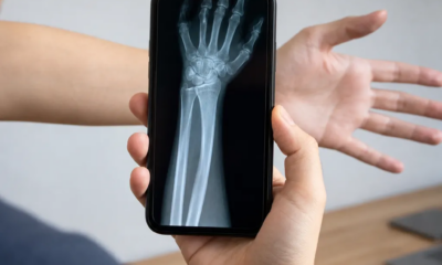 Raio-x virtual pela câmera do iPhone funciona mesmo