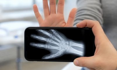 Simuleerige mobiiltelefoni kaamera röntgenikiirgust